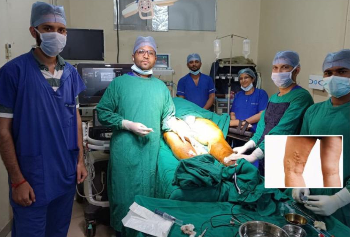 350th Laser Ablation performed in the Department of Vascular Interventional Radiology of RACGH
